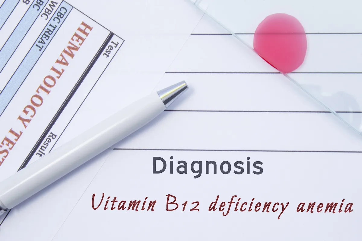 symptoms of vitamin b12 deficiency