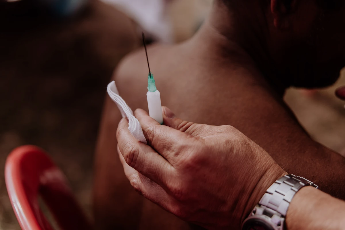 Cortisone shot in shoulder