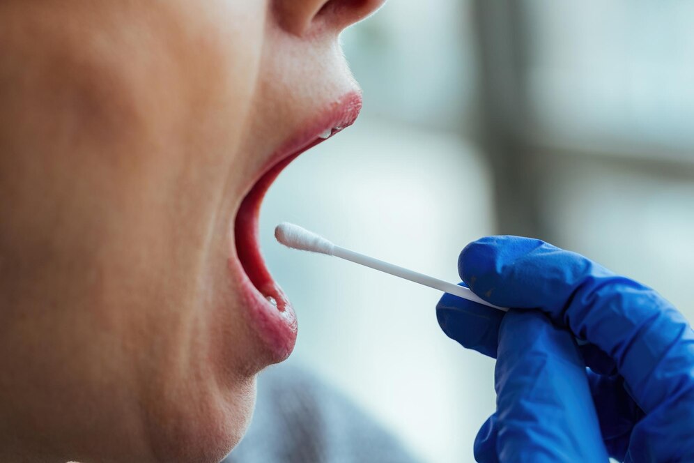 strep test being conducted by a primary care doctor on a patient in Kendall, FL