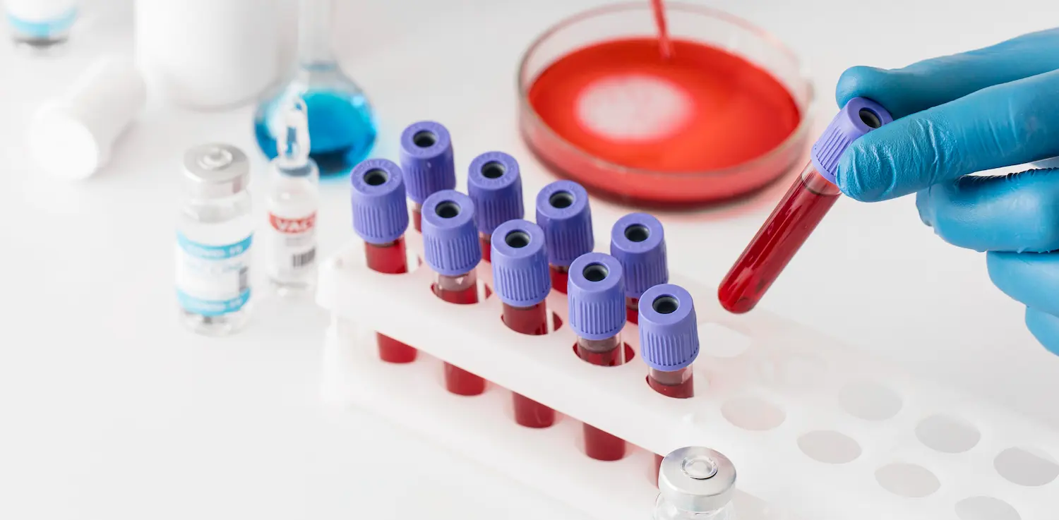 test tubes of blood tests for A/G ratio