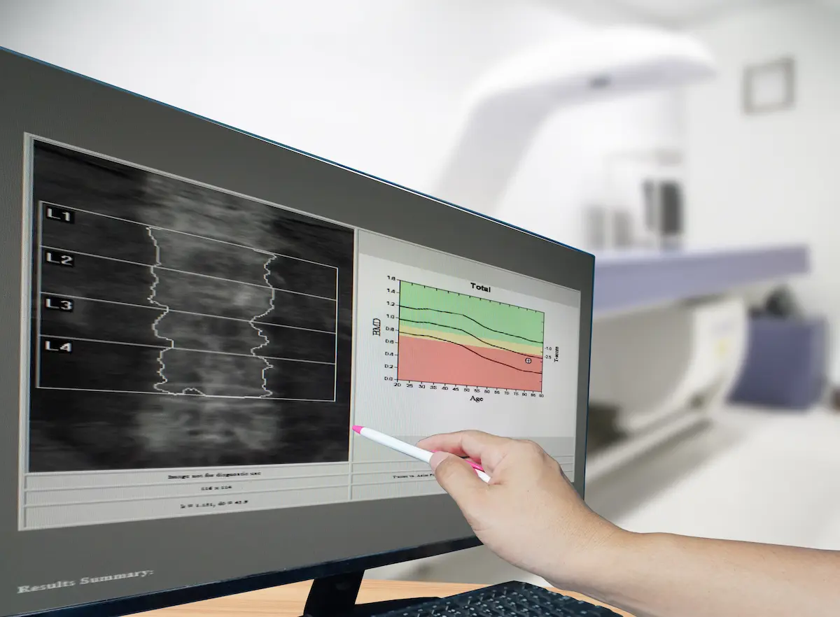 a doctor explaining does a bone density test show cancer