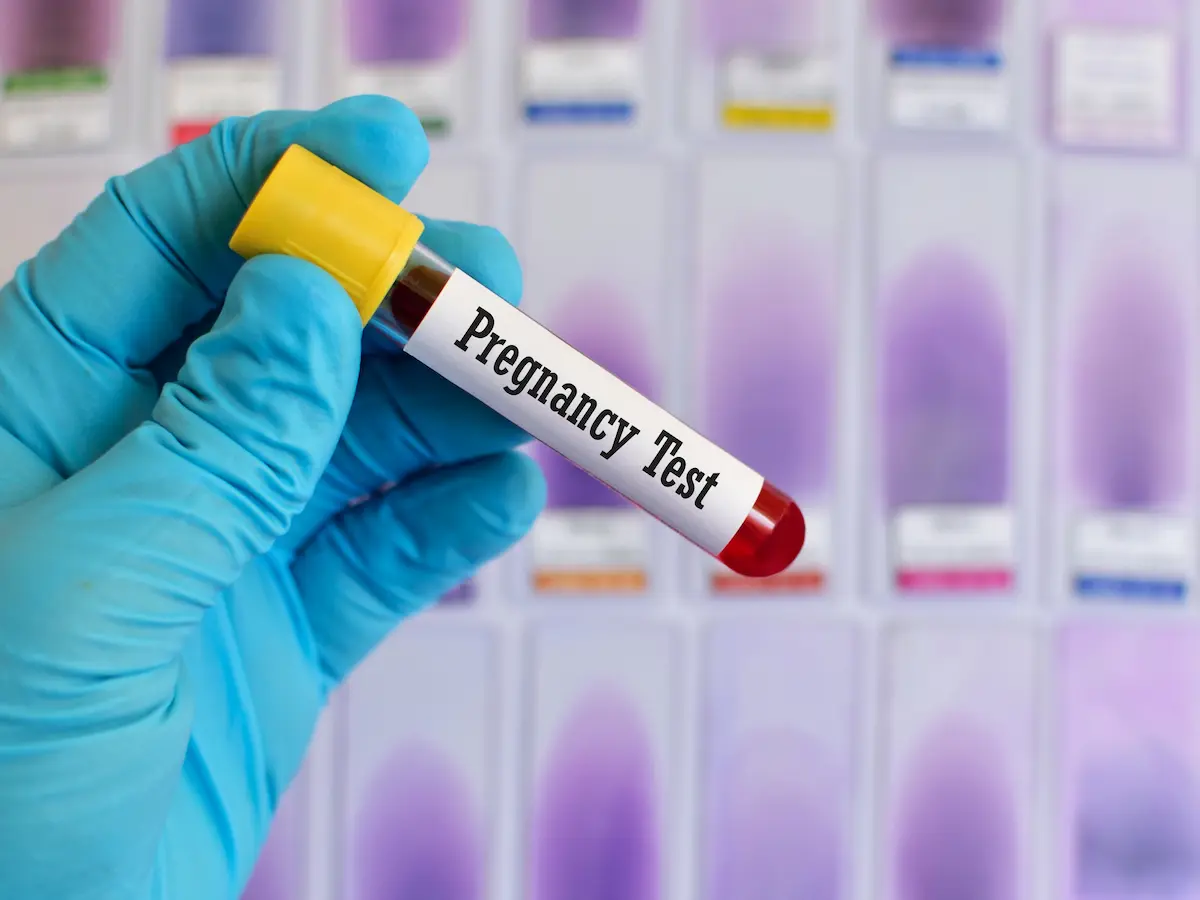 a doctor performing pregnancy blood testing