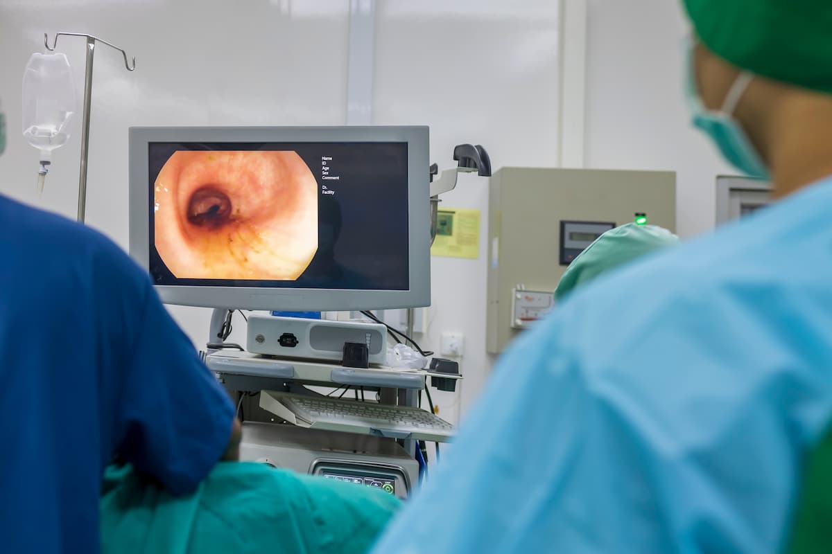 is-endoscopy-painful (1) is endoscopy painful