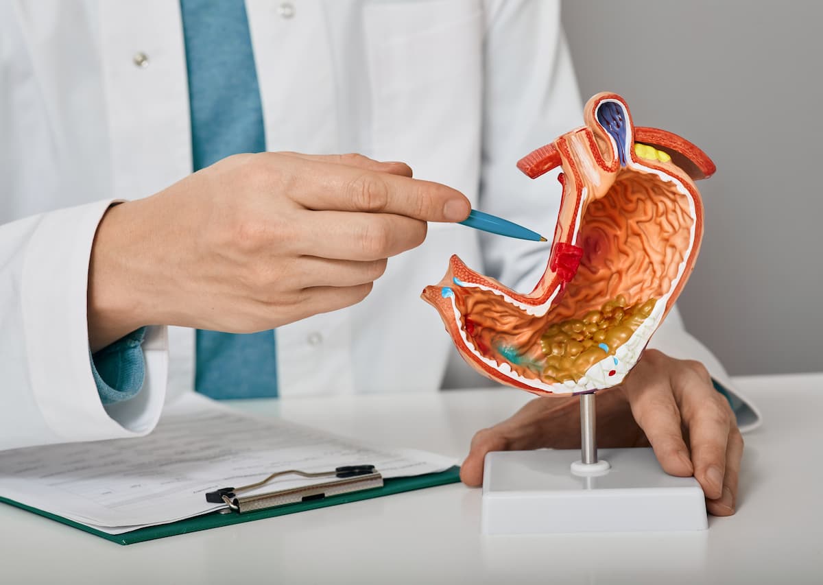 can a stomach ulcer heal on its own